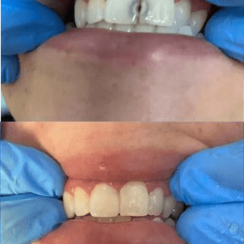 Restauração Estética