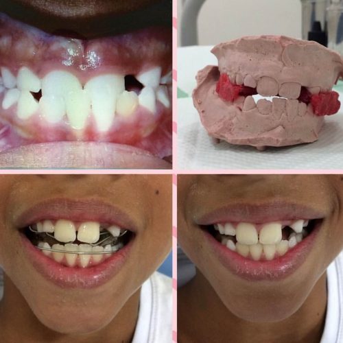 Ortodontia (aparelho)