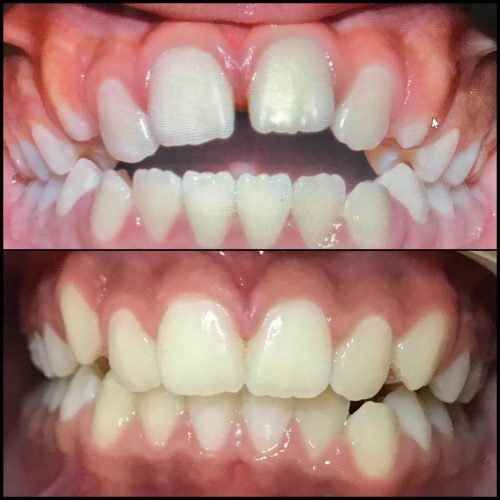 Ortodontia (aparelho)